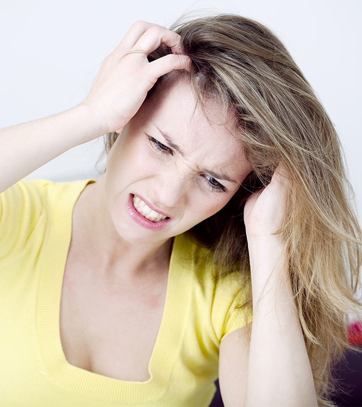 A woman with scalp psoriasis