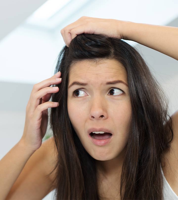 Women With Dandruff Issue Women With Dandruff Issue