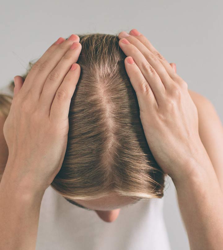Women Experiencing Hair Loss Due To Adderall Women Experiencing Hair Loss Due To Adderall