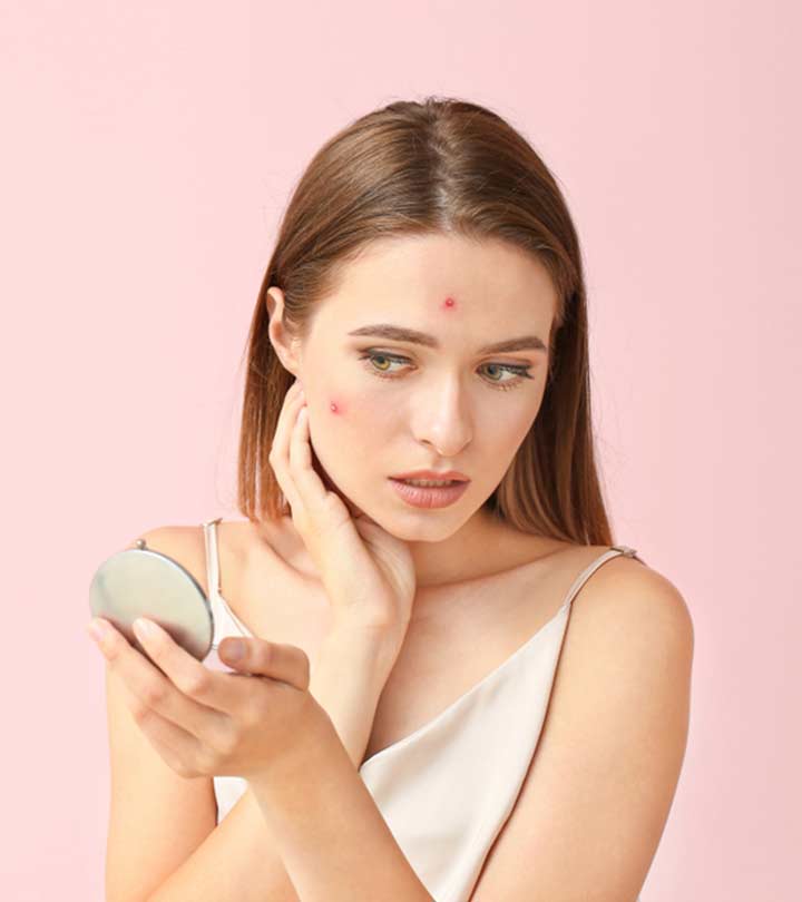 Woman Using Amoxicillin For Acne Woman Using Amoxicillin For Acne