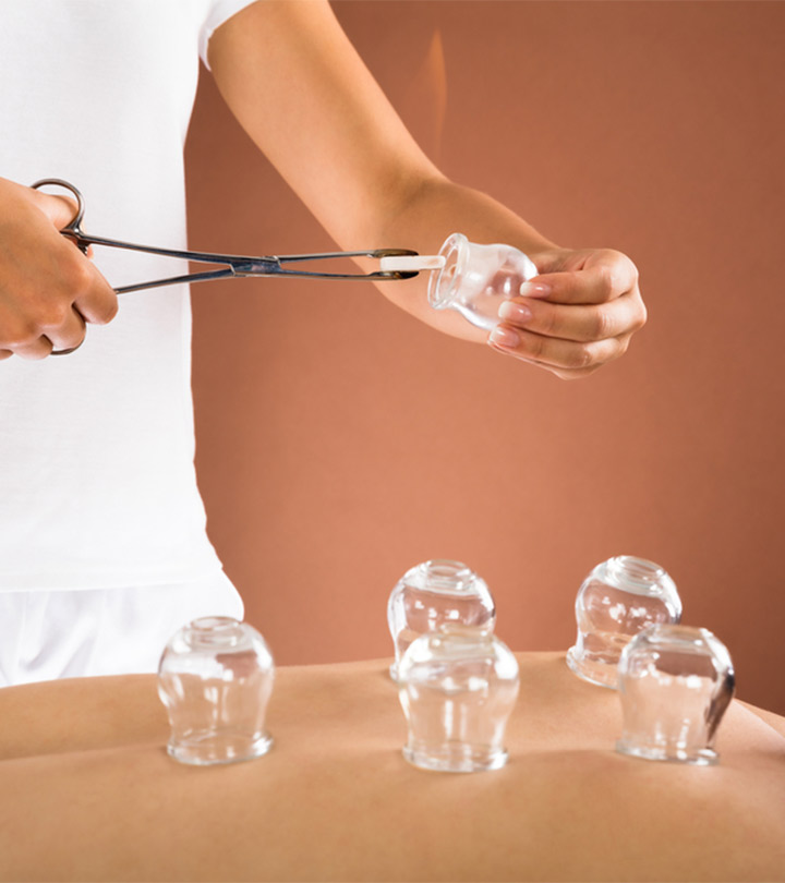 Cupping therapy procedures