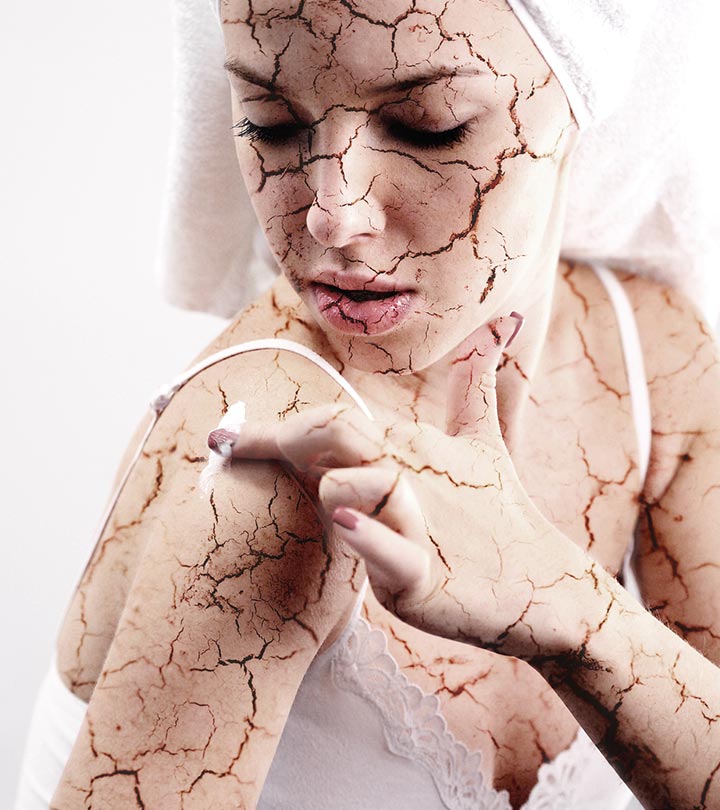 Woman With Dehydrated Skin