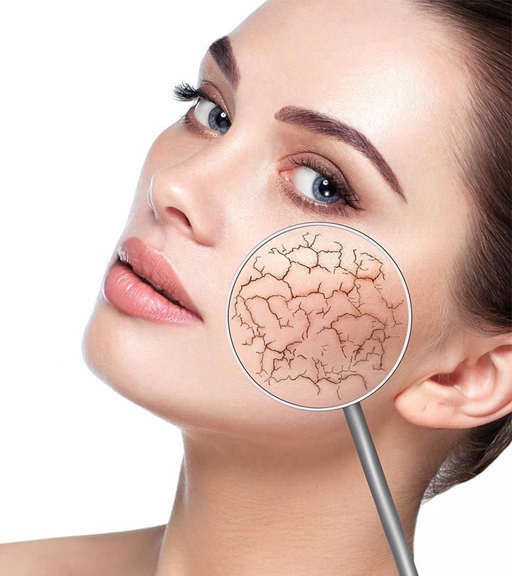 A woman with dry skin on her face