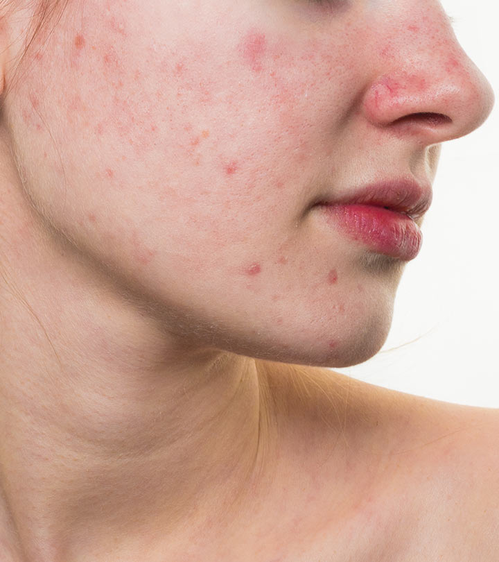 Women with Red Spots On The Skin