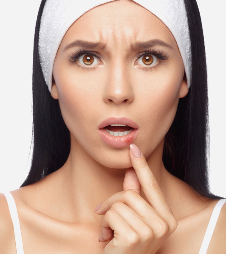 A girl showing her bleeding lips