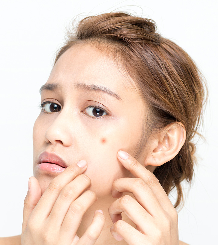Beneits Of Clindamycin For Acne Beneits Of Clindamycin For Acne