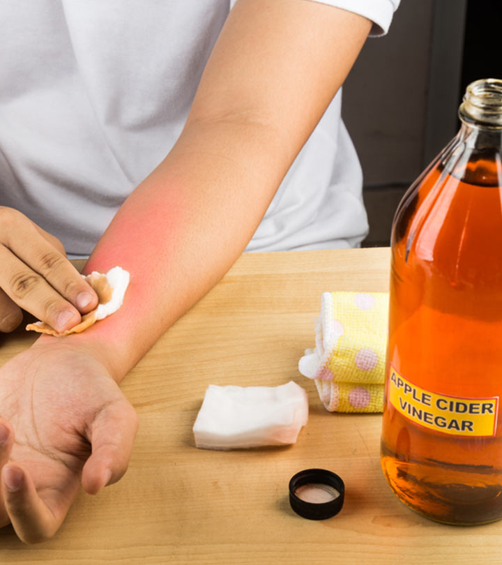 Person Applying Apple Cider Vinegar To His Skin Tags