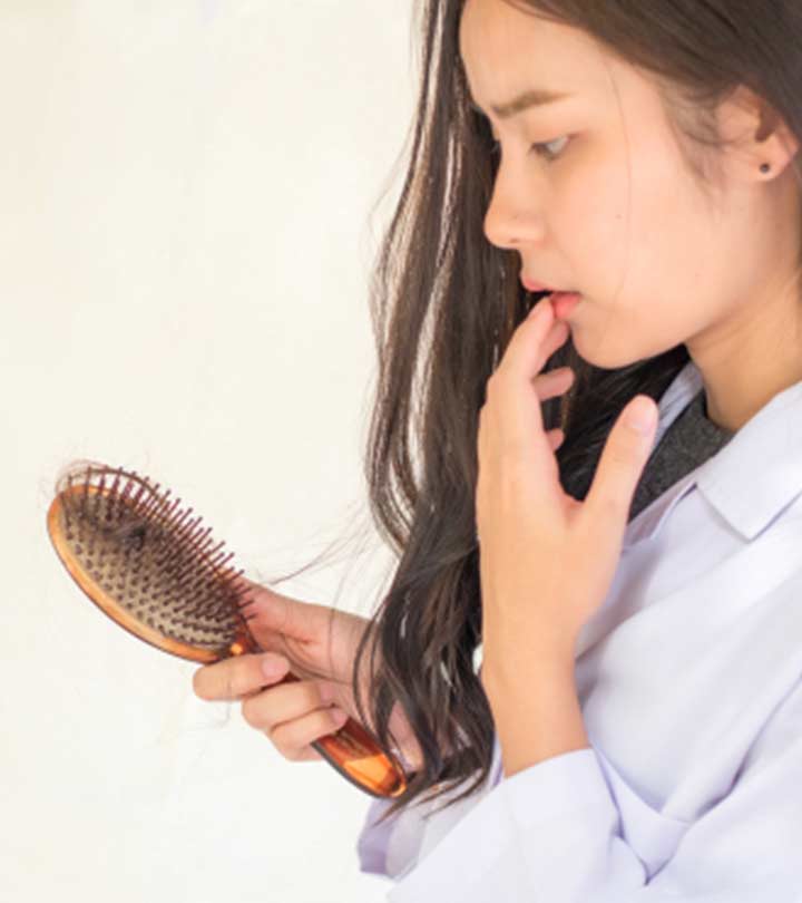 Woman Suffering From Seborrheic Dermatitis Hair Loss Woman Suffering From Seborrheic Dermatitis Hair Loss