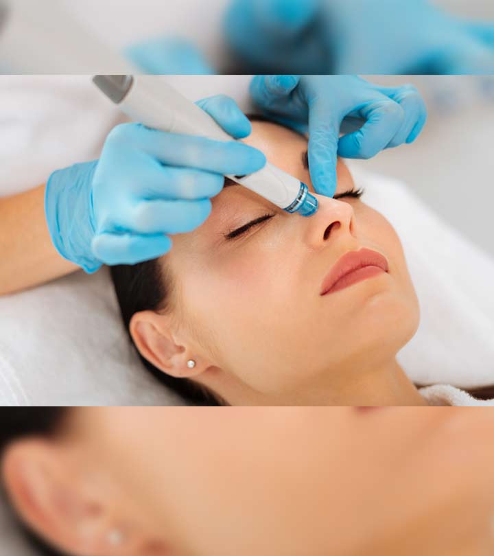 Woman Getting Dermalinfusion Facial Treatment