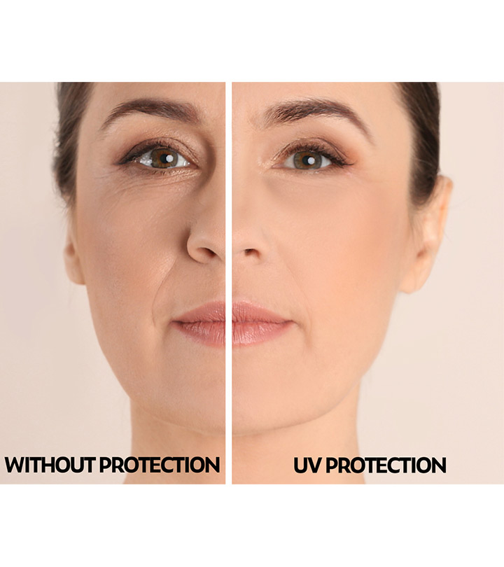 Signs Of Sun Damaged Skin