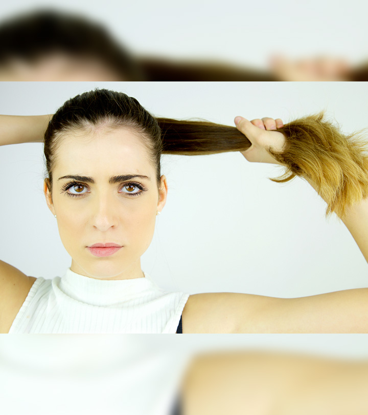 Woman With Traumatic Alopecia