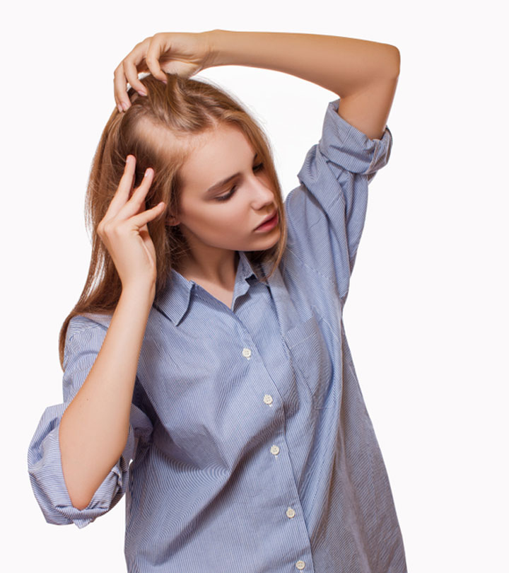 Women Suffering From Alopecia